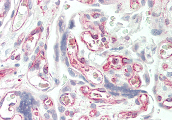 SLC38A3 Rabbit Polyclonal Antibody