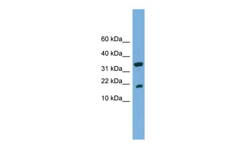ACP1 Rabbit Polyclonal Antibody