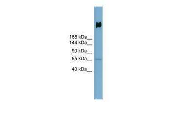 DMBT1 Rabbit Polyclonal Antibody