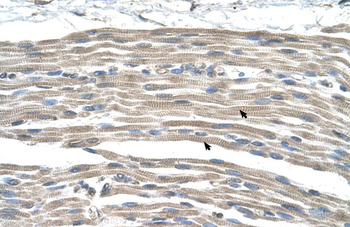 GPR161 Rabbit Polyclonal Antibody