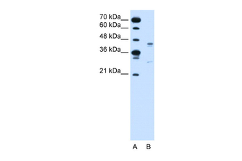 GPR161 Rabbit Polyclonal Antibody
