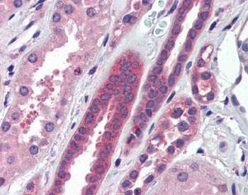 ATP6V0A2 Rabbit Polyclonal Antibody