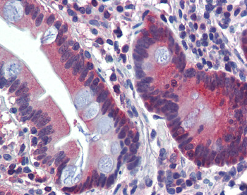 ATP6V0A2 Rabbit Polyclonal Antibody