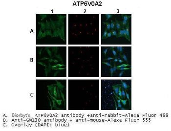 ATP6V0A2 Rabbit Polyclonal Antibody