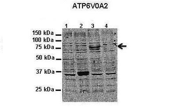 ATP6V0A2 Rabbit Polyclonal Antibody