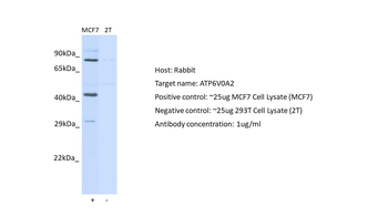 ATP6V0A2 Rabbit Polyclonal Antibody
