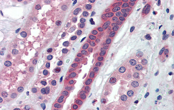 ATP6V0A2 Rabbit Polyclonal Antibody