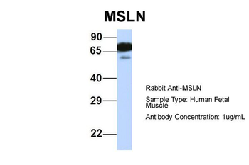 MSLN Rabbit Polyclonal Antibody