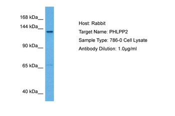 PHLPP2 Rabbit Polyclonal Antibody