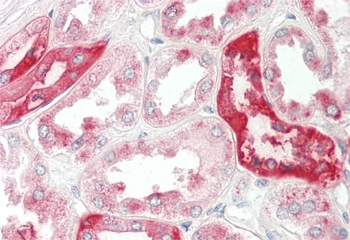 RHCG Rabbit Polyclonal Antibody