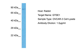 GTSE1 Rabbit Polyclonal Antibody