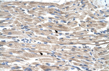 BMP2K Rabbit Polyclonal Antibody