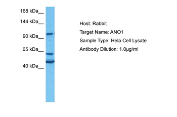 TMEM16A Rabbit Polyclonal Antibody
