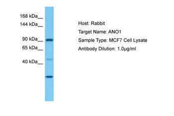 TMEM16A Rabbit Polyclonal Antibody