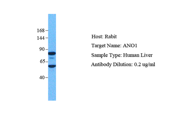 TMEM16A Rabbit Polyclonal Antibody