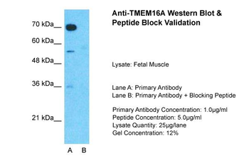 TMEM16A Rabbit Polyclonal Antibody