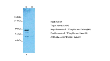 TMEM16A Rabbit Polyclonal Antibody