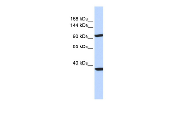 PAPPA2 Rabbit Polyclonal Antibody