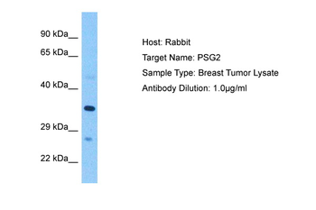 PSG2 Rabbit Polyclonal Antibody