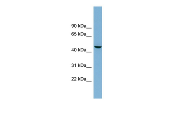 ALPG Rabbit Polyclonal Antibody