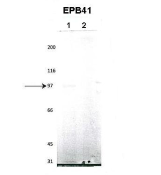EPB41 Rabbit Polyclonal Antibody
