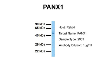 PANX1 Rabbit Polyclonal Antibody