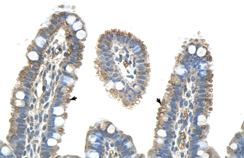 PANX1 Rabbit Polyclonal Antibody