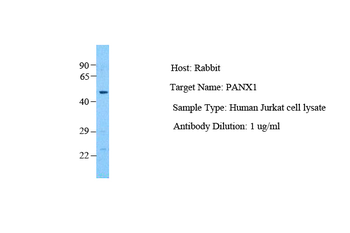 PANX1 Rabbit Polyclonal Antibody