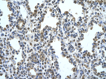 PANX1 Rabbit Polyclonal Antibody