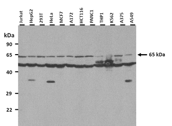HDAC9 Rabbit Polyclonal Antibody