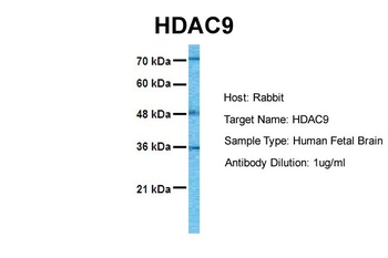 HDAC9 Rabbit Polyclonal Antibody