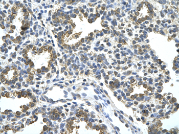 HDAC9 Rabbit Polyclonal Antibody