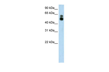 HDAC9 Rabbit Polyclonal Antibody