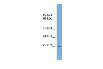 Rgs2 Rabbit Polyclonal Antibody