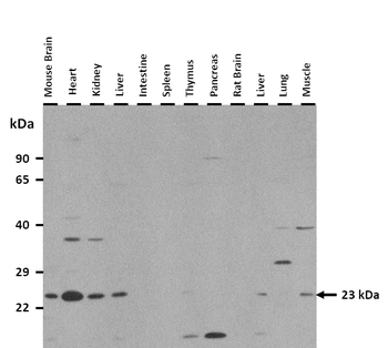 Rab13 Rabbit Polyclonal Antibody