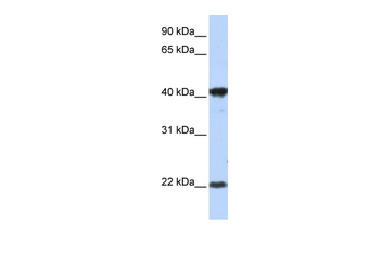 LIN7C Rabbit Polyclonal Antibody