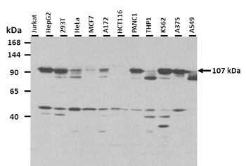 AMOTL1 Rabbit Polyclonal Antibody