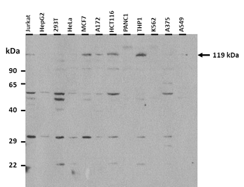 Rag1 Rabbit Polyclonal Antibody
