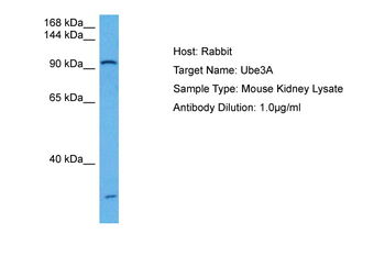 UBE3A Rabbit Polyclonal Antibody