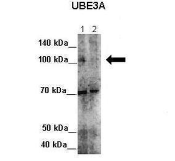 UBE3A Rabbit Polyclonal Antibody