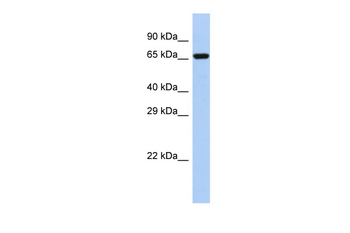 BARD1 Rabbit Polyclonal Antibody