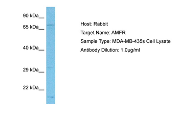 AMFR Rabbit Polyclonal Antibody