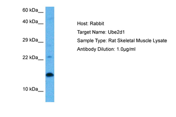 UBE2D1 Rabbit Polyclonal Antibody