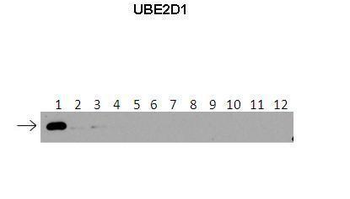 UBE2D1 Rabbit Polyclonal Antibody