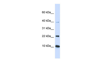 UBE2D2 Rabbit Polyclonal Antibody