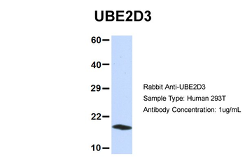 UBE2D3 Rabbit Polyclonal Antibody