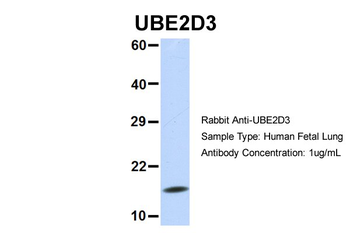 UBE2D3 Rabbit Polyclonal Antibody