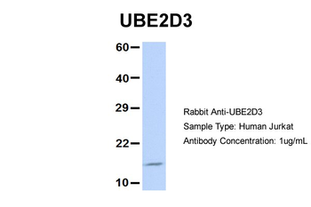 UBE2D3 Rabbit Polyclonal Antibody