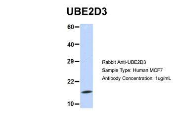 UBE2D3 Rabbit Polyclonal Antibody