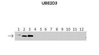 UBE2D3 Rabbit Polyclonal Antibody